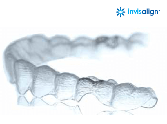 invisalign_aligner.PNG